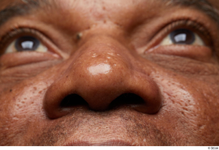 HD Face Skin Everson Baker face nose skin pores skin…
